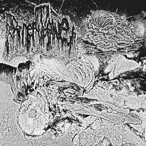 Fermentative : Fermentative - Botched Anastomosis J-Pouch